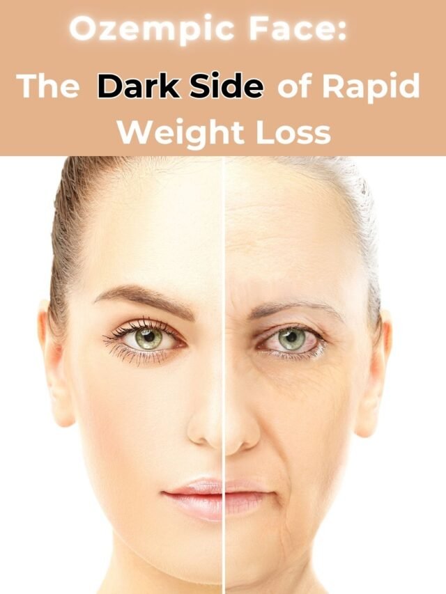 A digitally edited image of a woman's face split in half, showing a youthful side on the left and an aged, wrinkled side on the right, illustrating the effects of rapid weight loss on facial appearance. The text overlay reads: "Ozempic Face: The Dark Side of Rapid Weight Loss